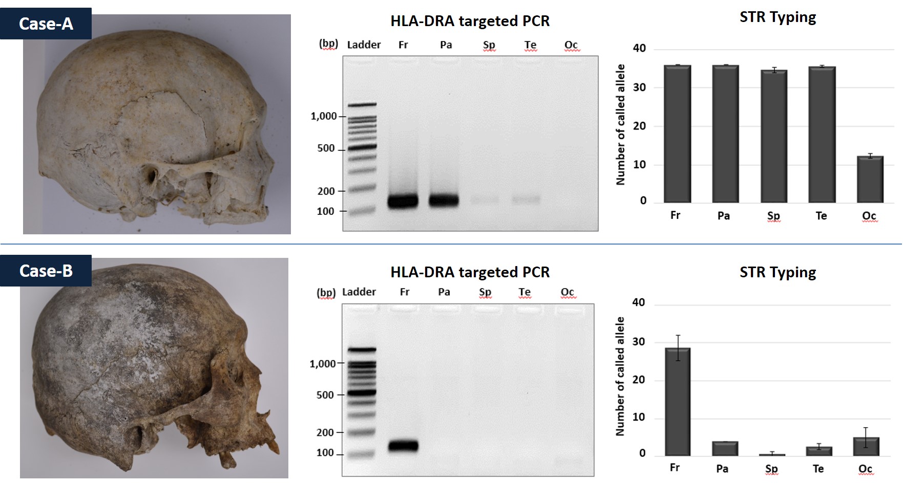 AST-2025-040_R1_P_Graphical Abstract_001.jpg